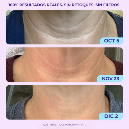 Crema reafirmante para cuello y escote