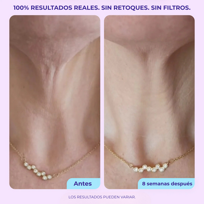 Crema reafirmante para cuello y escote